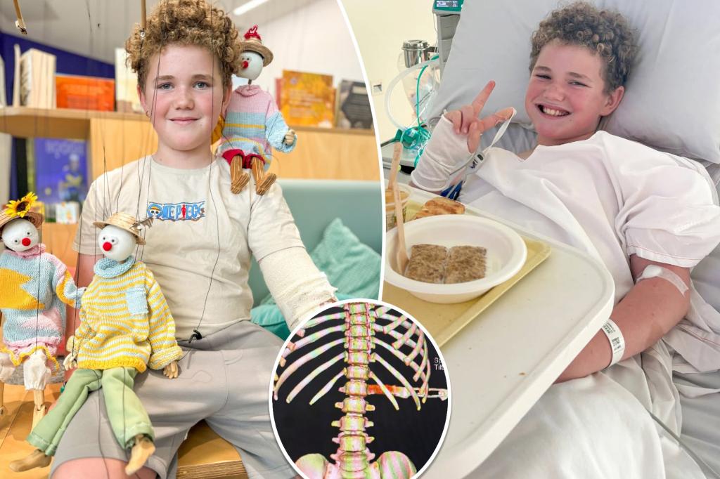The 10-year-old escapes from the paralysis from the 'Milimeter Change' after falling into the steak knife while making grilled cheese